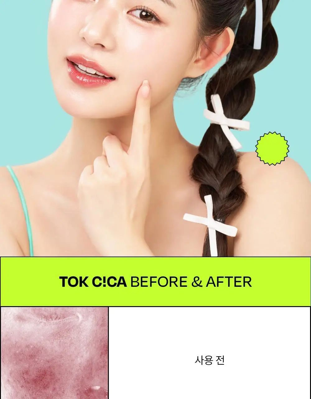 [붉은피부진정/겉속보습] 에딧비 진정 톡 시카 어성초 겔 에센스 200ml 상세페이지 12